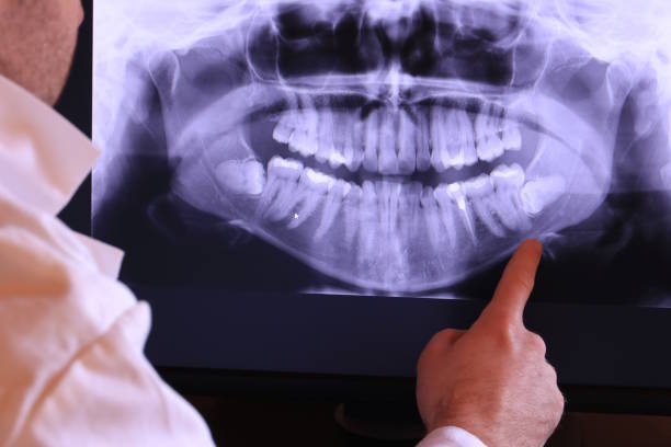 Best Emergency Gum Treatment in Fort Hall, ID