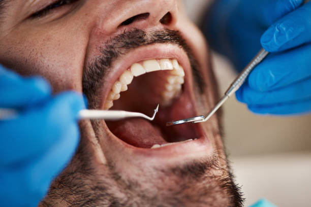 Best Emergency Treatment for Dental Infections or Abscesses in Fort Hall, ID
